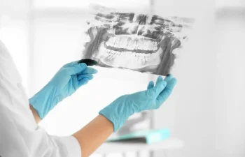 A person wearing blue gloves holds a dental X-ray image, displaying teeth and jaw structure, in a clinical setting.