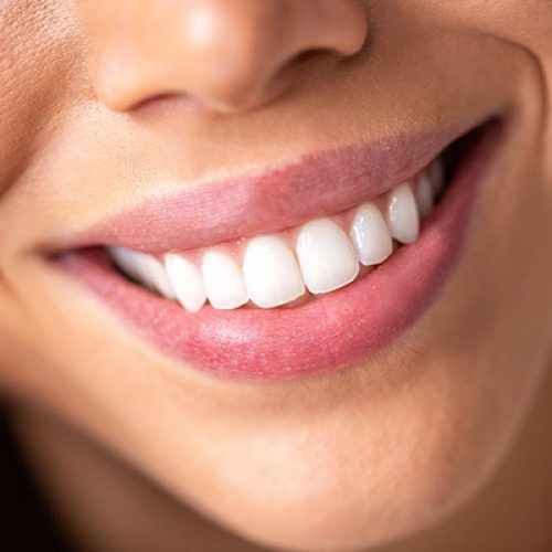 full-mouth-reconstruction-2101