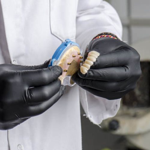 Dental technician holding a monolithic zirconia restorations full arch implant  supported with the ceramic load in vestibular.