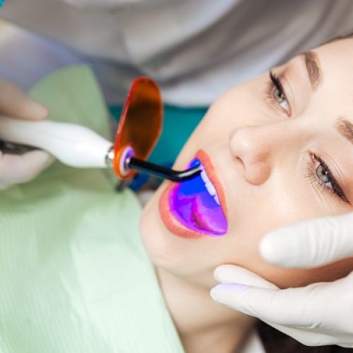 Close-up,Portrait,Of,A,Female,Patient,Getting,A,Bleach,Treatment