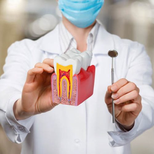 Dental treatment service concept. The dentist shows the model teeth and tool on a blurred background.